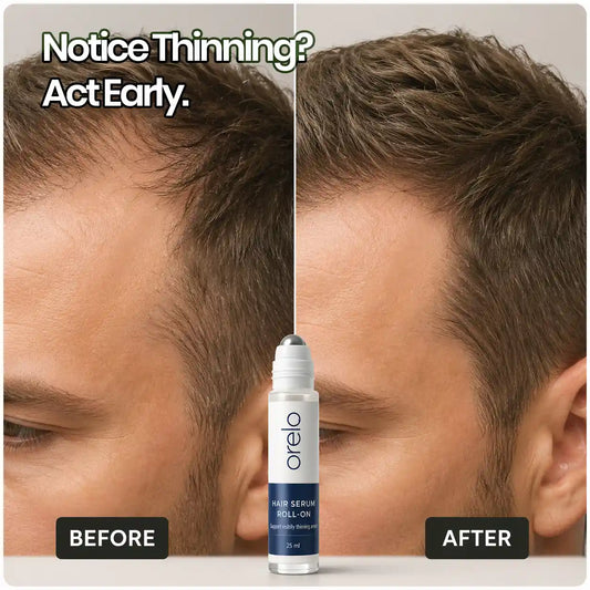 Orelo Hair Growth Roll-On Serum