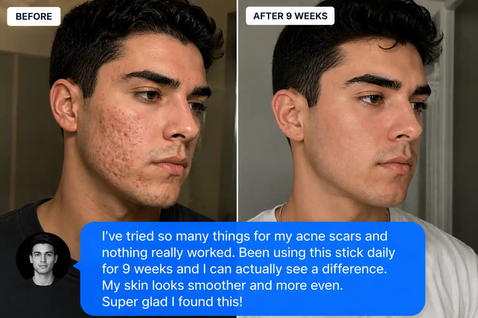 Clinical Scar Recovery Stick™